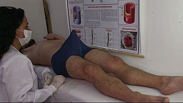 Nurse Observes Patient’s Erection